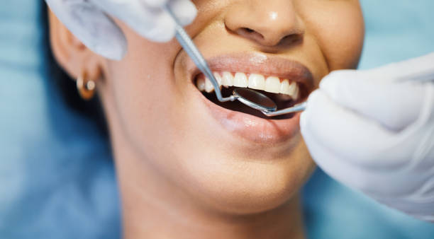Teeth Whitening in UT
